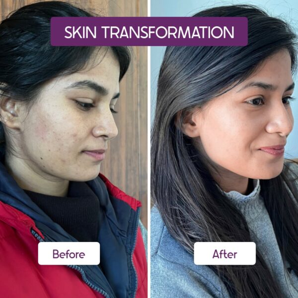 salicylic-acid-bha-2-encapsulated-30ml-342815.jpg salicylic-acid-bha-2-encapsulated-30ml-342815.jpg