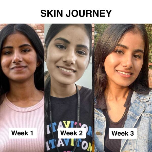 vitamin-cef-20-face-serum-30ml-205984.jpg vitamin-cef-20-face-serum-30ml-205984.jpg